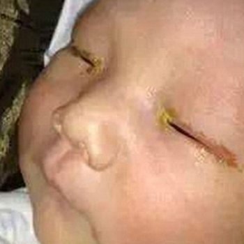 El riesgo de dejar ciego a un bebé por usar el flash en una fotografía