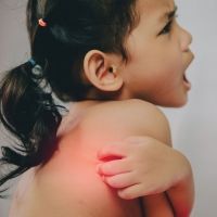 Guía para identificar picaduras de insectos en los niños