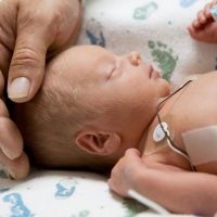 Las dudas más comunes sobre bebés prematuros