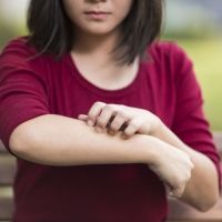 La dermatitis atópica y la obesidad infantil