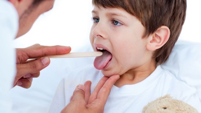 Amigdalitis: dolor de garganta en los niños