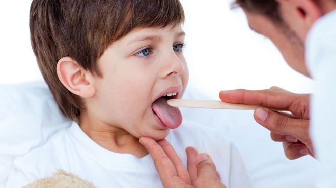 ¿Cuándo operar de anginas a los niños?
