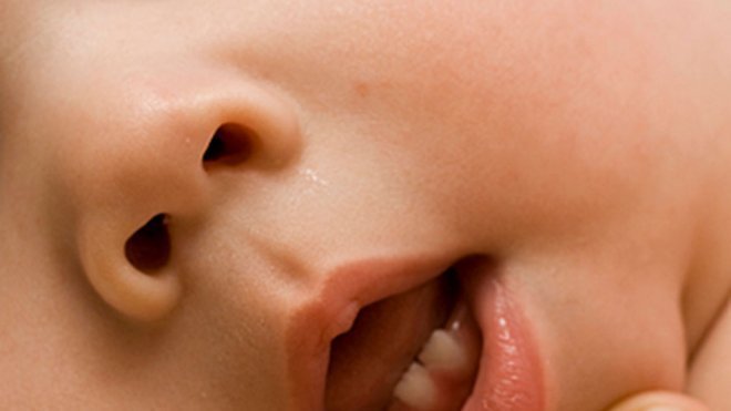 ¿Por qué están irritables los bebés cuando les salen los dientes?