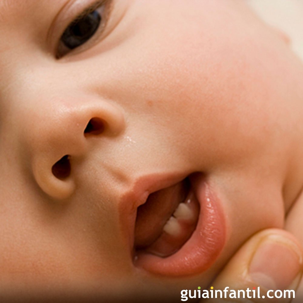 Cuando el bebé vomita la leche de fórmula. ¿Qué puede indicarnos?