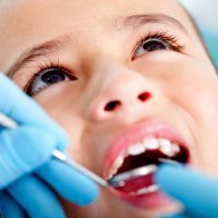 El sellado de los dientes, prevención contra la caries infantil