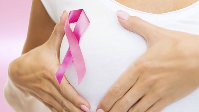 Factores de riesgo y controles periódicos del cáncer de mama