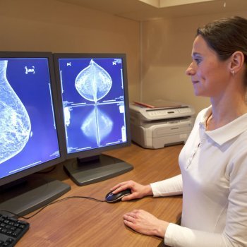 Nódulos que indican cáncer