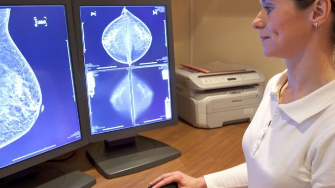 ¿Los nódulos que duelen son o no son cancerígenos?