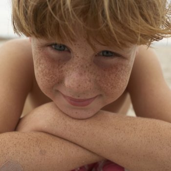 Distinguir los distintos tipos de pecas