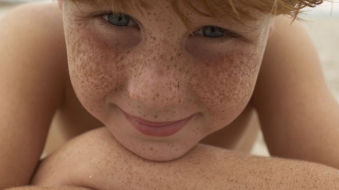Distinguir los distintos tipos de pecas