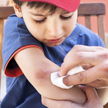 Errores al curar una herida