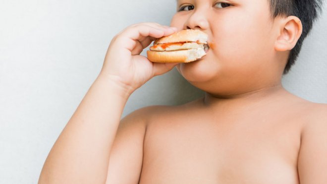 Cómo tratar la obesidad infantil