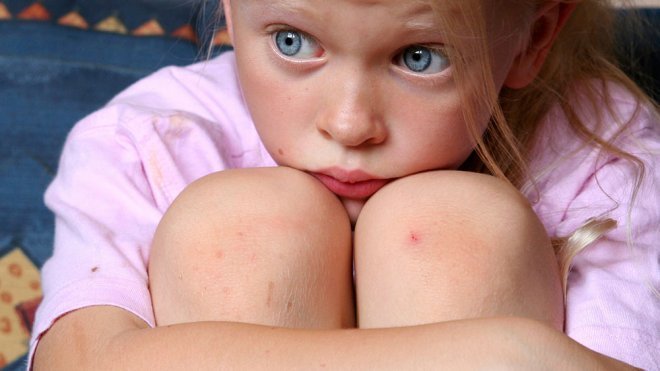 Diferencias en los miedos de niños y niñas