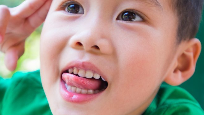 ¿Qué es la dislalia infantil y cómo se detecta?