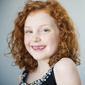 Blanqueamiento de los dientes de los niños