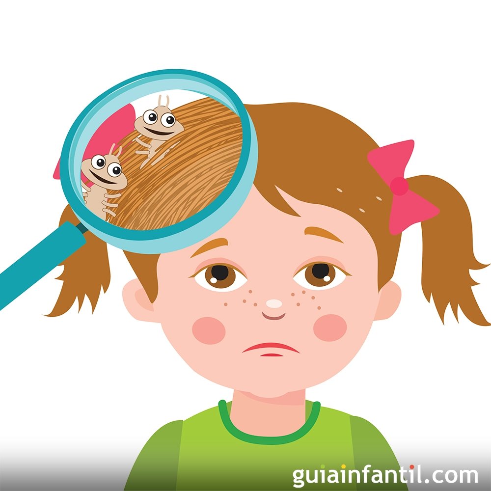 Cómo prevenir los piojos en los niños? - Criar con Sentido Común
