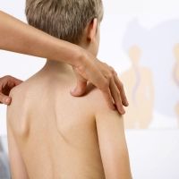 Tratamientos para los problemas de espalda