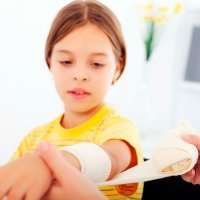 Cómo curar una quemadura. Primeros auxilios para niños