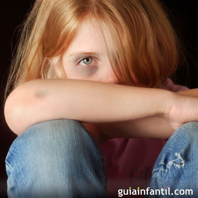 Los derechos de los niños más vulnerados