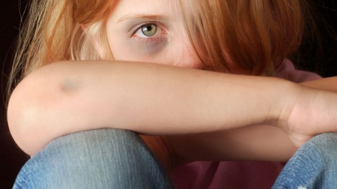 Los derechos de los niños más vulnerados