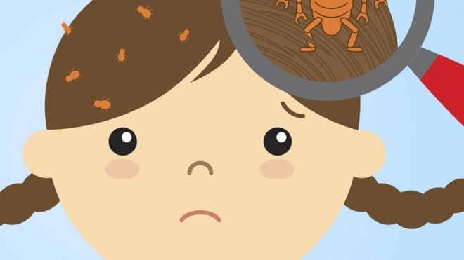 Cómo eliminar los piojos del pelo de los niños definitivamente