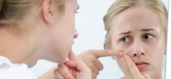 Alimentación y acné Alimentación y acné