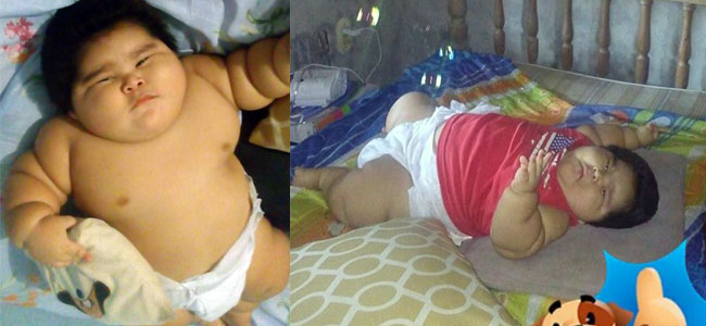 El bebé más obeso del mundo El bebé más obeso