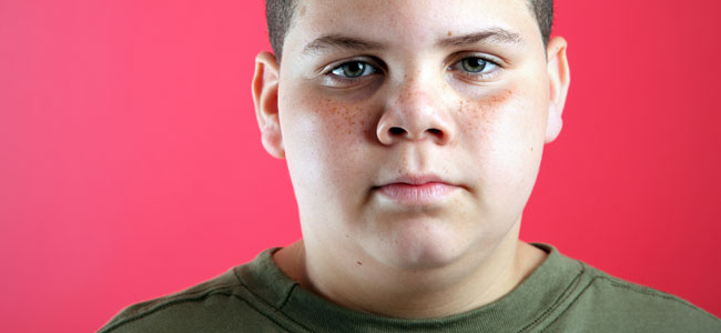 Problemas de la obesidad en la adolescencia