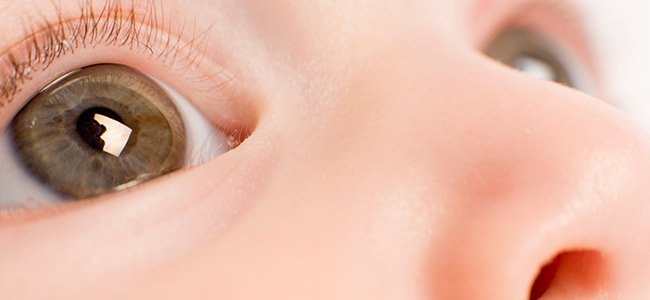 Astigmatismo en bebés