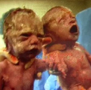 Gemelas de la mano en el momento del nacimiento Gemelas de la mano en el momento del nacimiento