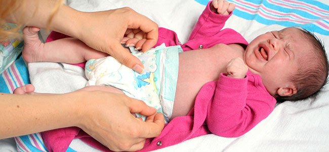 Fértil Increíble Ejercicio mañanero Cómo tratar las rozaduras del pañal en el bebé