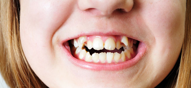 Burlas a niños que tienen un defecto físico