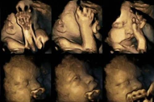 Ecografía de bebé de mamá fumadora