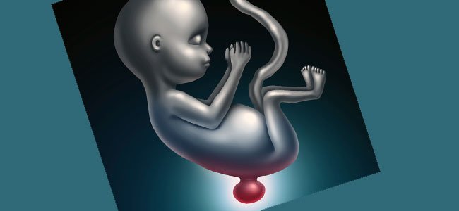 Cómo prevenir la espina bífida