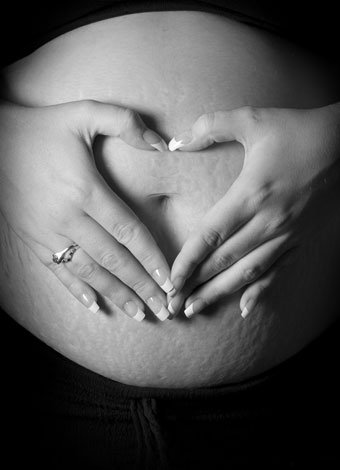 Las marcas en el cuerpo de la mujer después del embarazo Las marcas en el cuerpo de la mujer después del embarazo