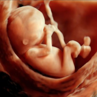 Ecografías de bebés