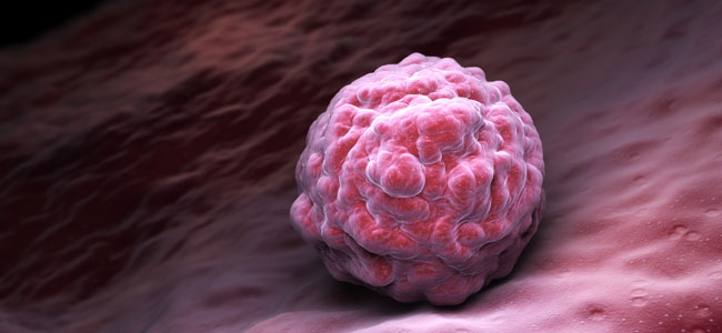 Sangrado por implantación, cómo diferenciarlo de la menstruación Sangrado por implantación, cómo diferenciarlo de la menstruación