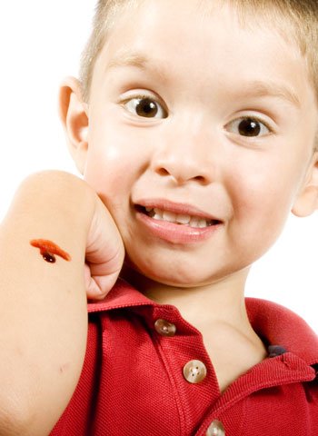 Reacciones de los niños a las heridas