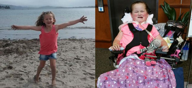 Afm enfermedad que paraliza a los niños