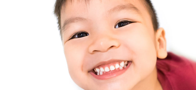 Bruxismo dental en los niños
