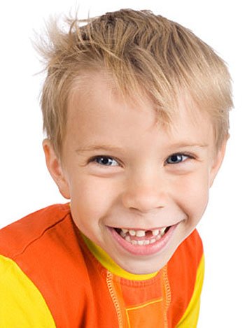 La rotura de los dientes de los niños