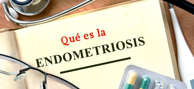 Qué es la endometriosis Qué es la endometriosis