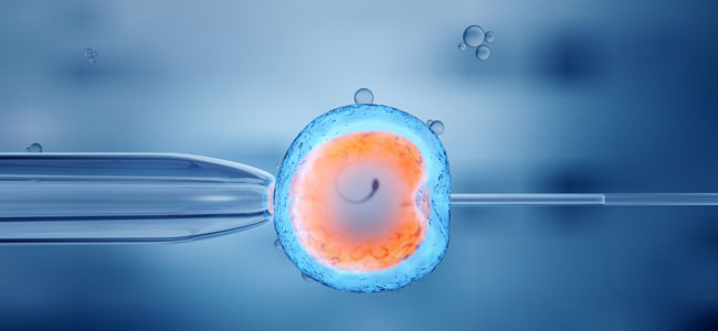 Inseminación artificial Inseminación artificial