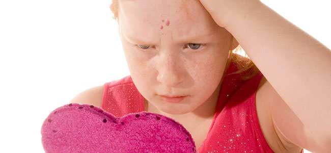 El molusco contagioso en niños