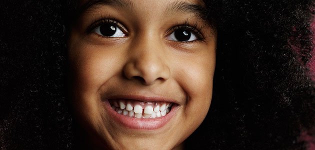 Niña con dientes separados