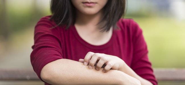 Psoriasis infantil Niño rascándose cara