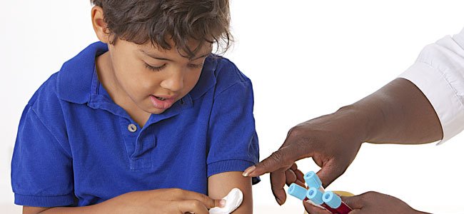 La enfermedad de púrpura en los niños Análisis de sangre niño