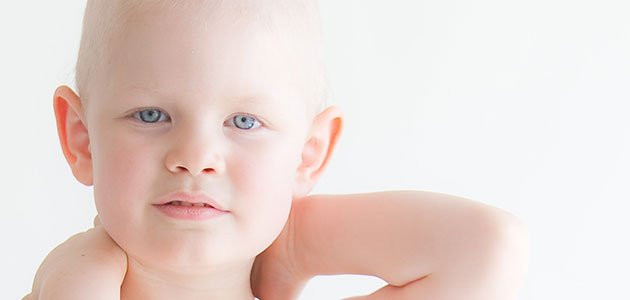 Causas y prevención del cáncer infantil Niña con cáncer