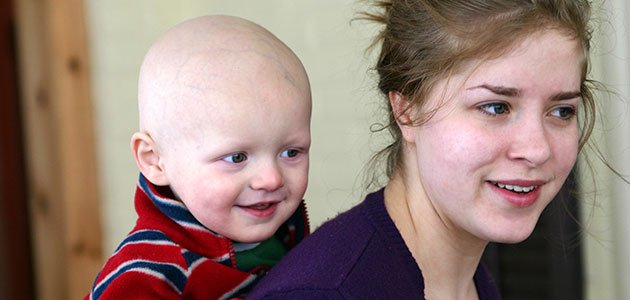 El apoyo al niño con cáncer Madre con bebé