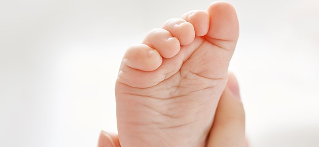 Problemas ortopédicos infantiles